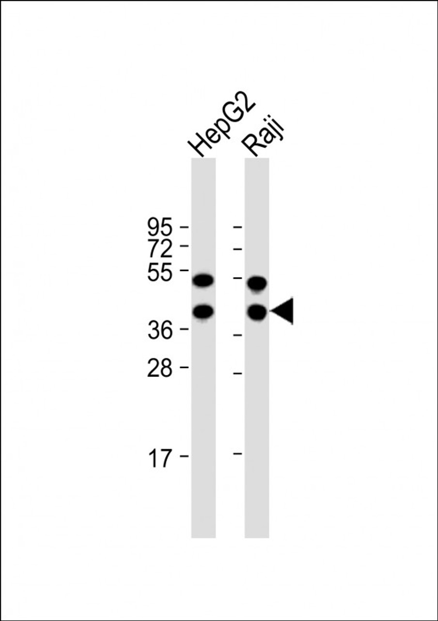 Western Blot at 1:1000 dilution Lane 1: HepG2 whole cell lysate Lane 2: Raji whole cell lysate Lysates/proteins at 20 ug per lane.