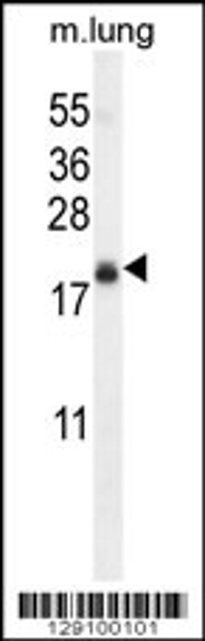 Western blot analysis in mouse lung tissue lysates (35ug/lane) .