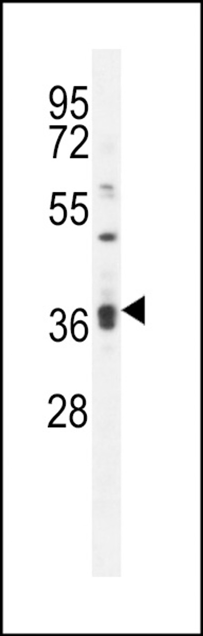 Western blot analysis in MDA-MB231 cell line lysates (35ug/lane) .