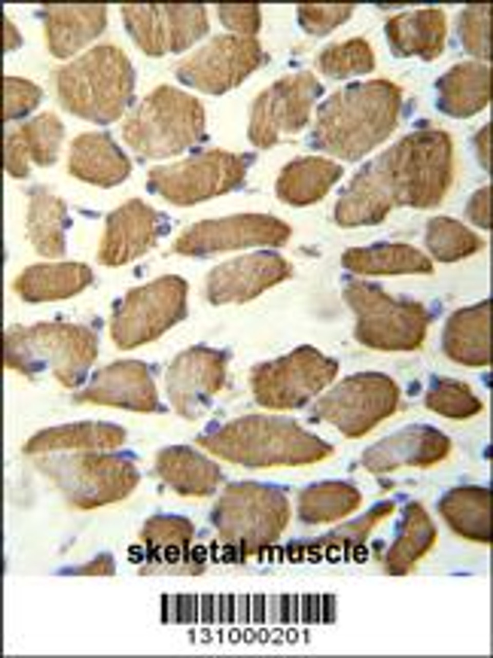 hCG_1645727 Antibody immunohistochemistry analysis in formalin fixed and paraffin embedded human skeletal muscle followed by peroxidase conjugation of the secondary antibody and DAB staining.