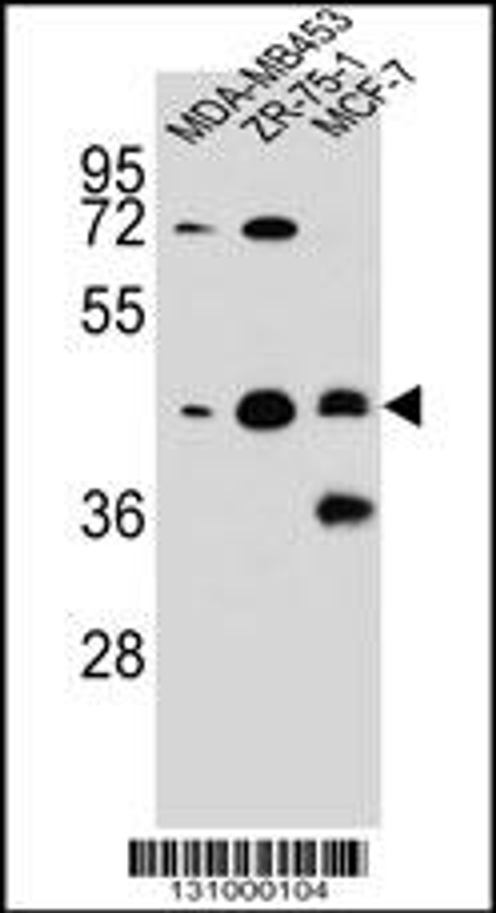 Western blot analysis in MDA-MB453, ZR-75-1, MCF-7 cell line lysates (35ug/lane) .