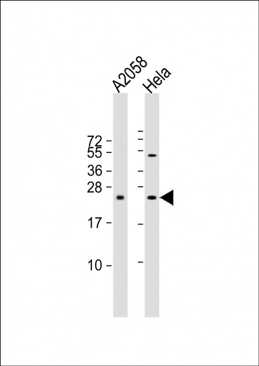 Western Blot at 1:2000 dilution Lane 1: A2058 whole cell lysate Lane 2: Hela whole cell lysate Lysates/proteins at 20 ug per lane.