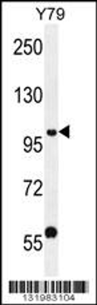 Western blot analysis in Y79 cell line lysates (35ug/lane) .