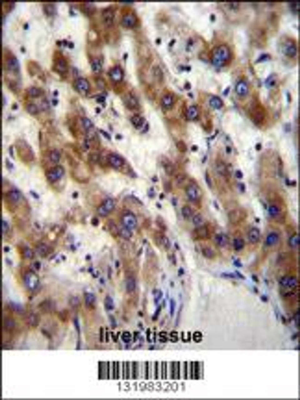 PHF20 Antibody immunohistochemistry analysis in formalin fixed and paraffin embedded human liver tissue followed by peroxidase conjugation of the secondary antibody and DAB staining.