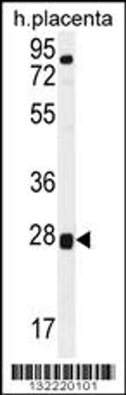 Western blot analysis in human placenta tissue lysates (35ug/lane) .