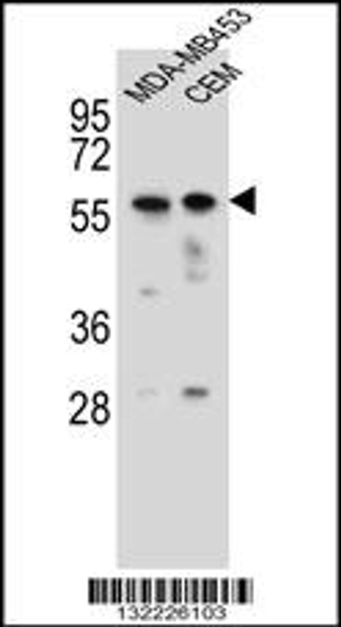 Western blot analysis in MDA-MB453, CEM cell line lysates (35ug/lane) .