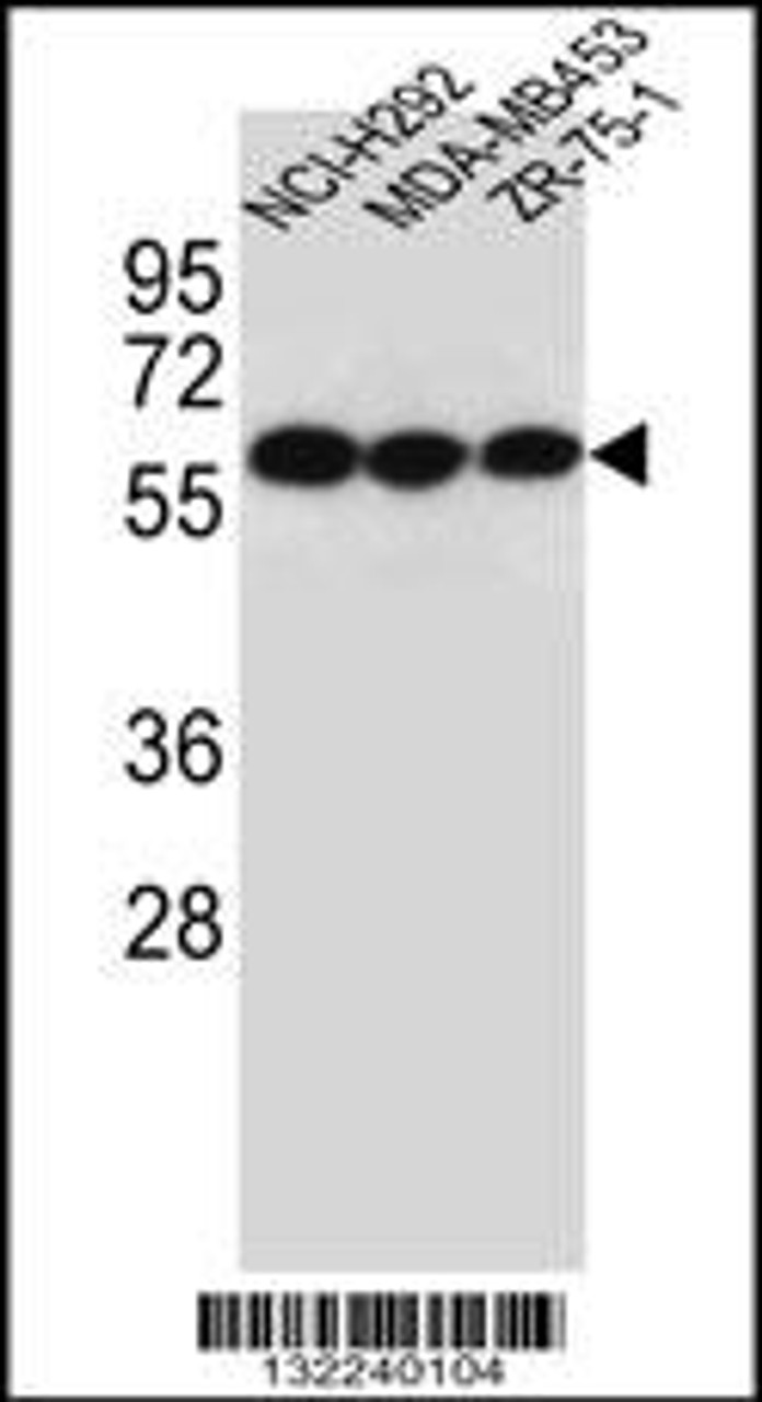 Western blot analysis in NCI-H292, MDA-MB453, ZR-75-1 cell line lysates (35ug/lane) .