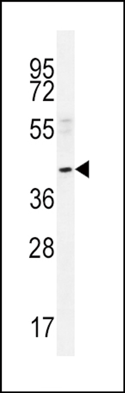 Western blot analysis in A549 cell line lysates (35ug/lane) .