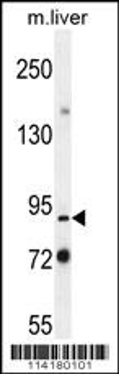 Western blot analysis in mouse liver tissue lysates (35ug/lane) .