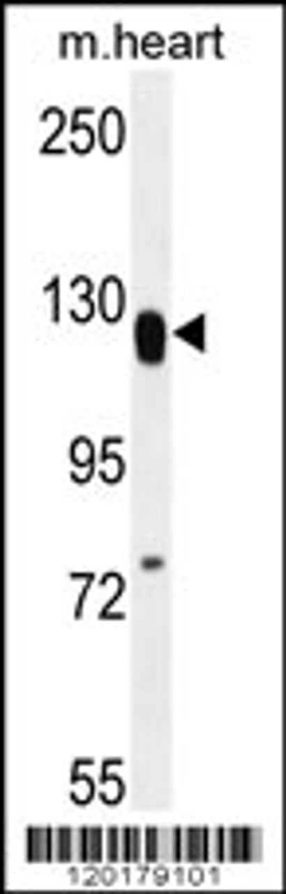 Western blot analysis in mouse heart tissue lysates (35ug/lane) .