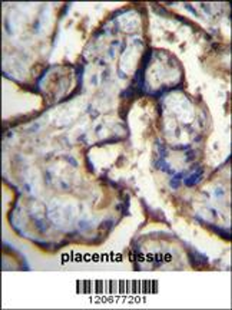 ITGA5 Antibody immunohistochemistry analysis in formalin fixed and paraffin embedded human placenta tissue followed by peroxidase conjugation of the secondary antibody and DAB staining.