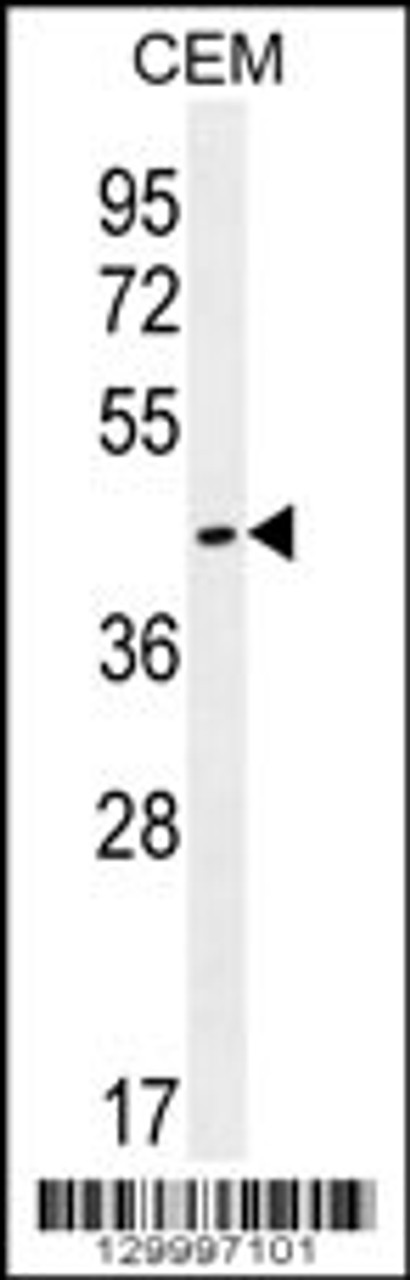 Western blot analysis in CEM cell line lysates (35ug/lane) .