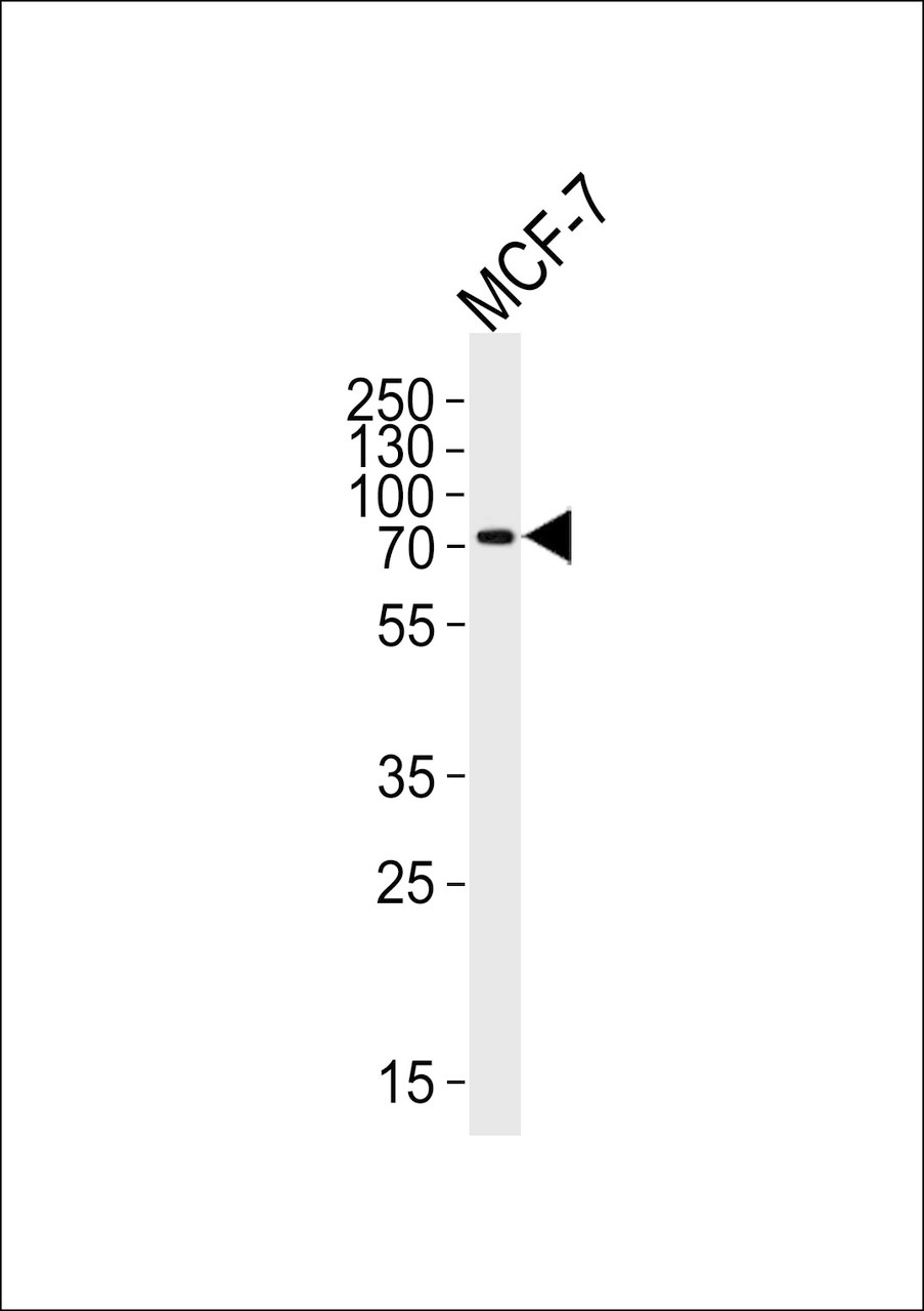 Western blot analysis of lysate from MCF-7 cell line, using KLC2 Antibody at 1:1000 at each lane.