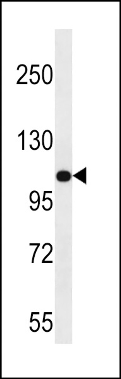 Western blot analysis in uterus tumor cell line lysates (35ug/lane) .