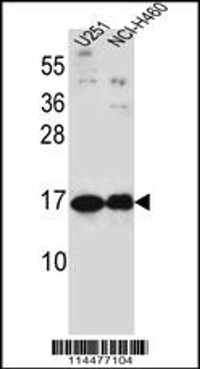 Western blot analysis in U251, NCI-H460 cell line lysates (35ug/lane) .