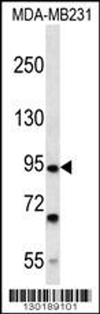 Western blot analysis in MDA-MB231 cell line lysates (35ug/lane) .