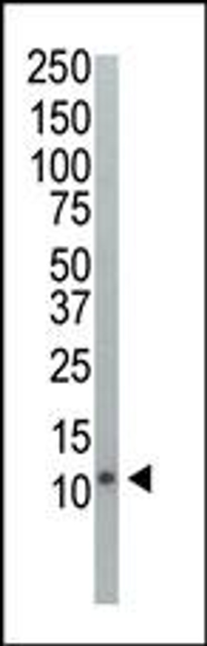 Western blot analysis of anti-Ubiquitin Pab in HeLa cell lysate. Ubiquitin was detected using purified Pab.