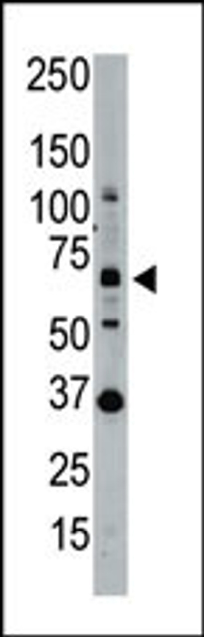 Western blot analysis of SENP1 polyclonal antibody in whole HL60 cell lysate: SENP1 was detected using purified Pab.