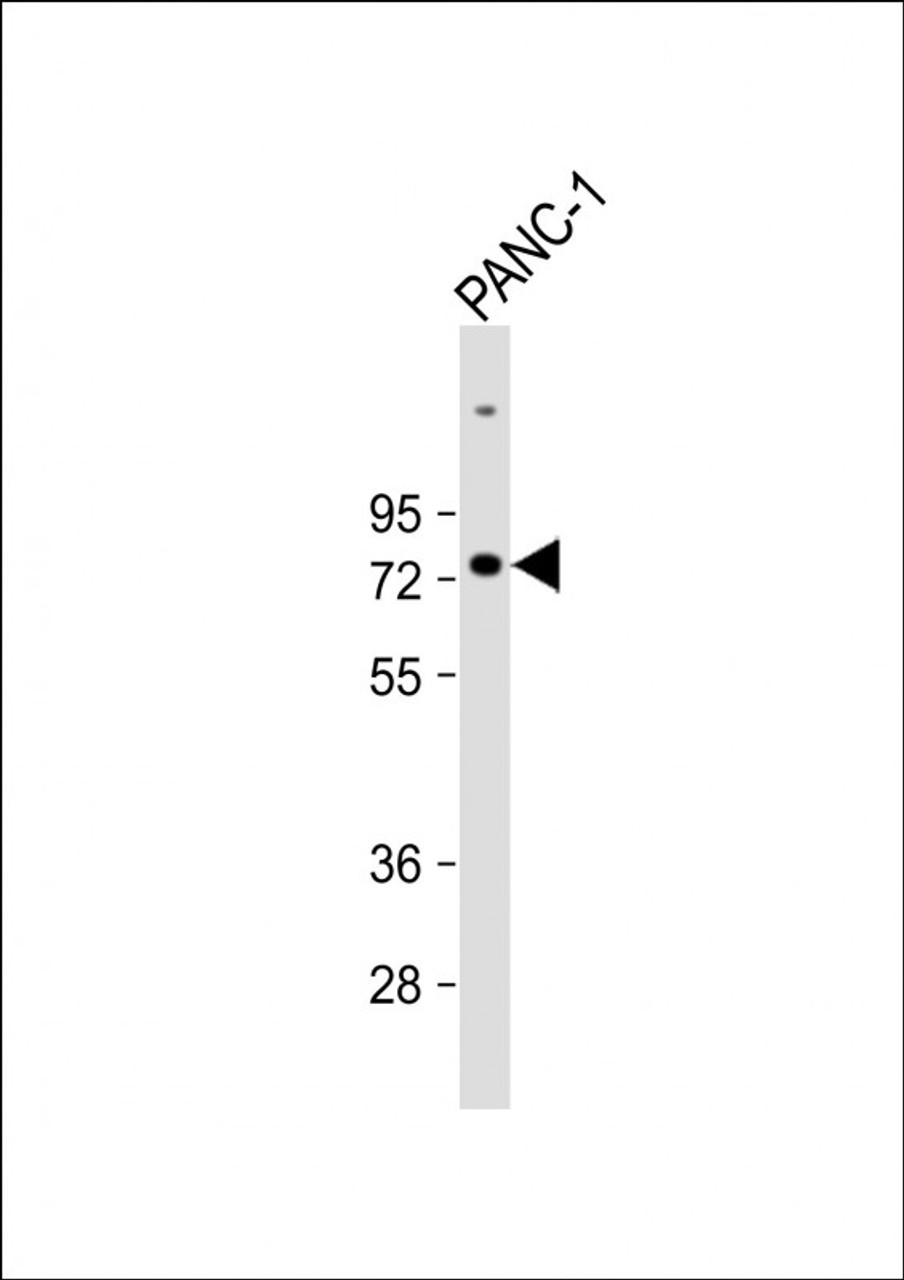 Western Blot at 1:1000 dilution + PANC-1 whole cell lysate Lysates/proteins at 20 ug per lane.