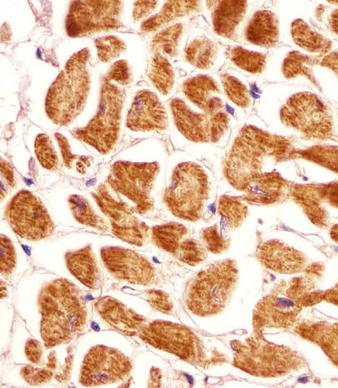 Antibody staining PCCA in human heart tissue sections by Immunohistochemistry (IHC-P - paraformaldehyde-fixed, paraffin-embedded sections) .