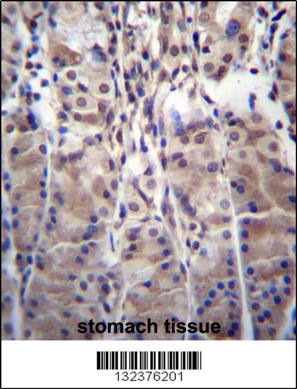 MDM1 Antibody immunohistochemistry analysis in formalin fixed and paraffin embedded human stomach tissue followed by peroxidase conjugation of the secondary antibody and DAB staining.