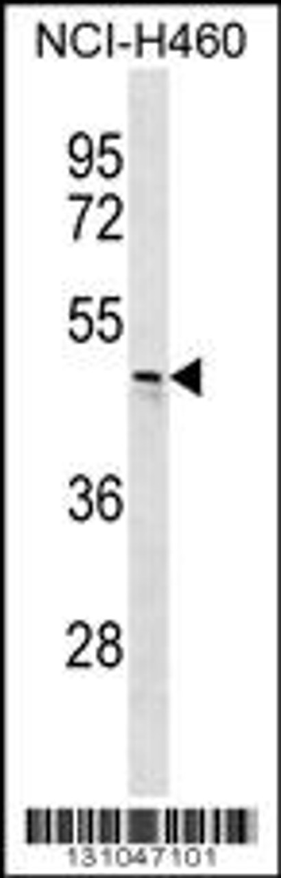 Western blot analysis in NCI-H460 cell line lysates (35ug/lane) .