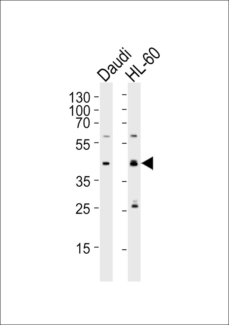 Western blot analysis of lysates from Daudi, HL-60 cell line (from left to right) , using C109B Antibody at 1:1000 at each lane.