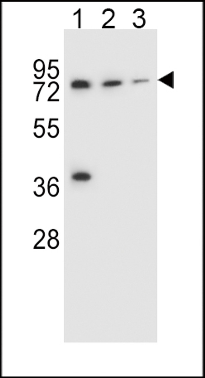 Western blot analysis in NCI-H460 (lane 1) , HepG2 (lane 2) , ZR-75-1 (lane 3) cell line lysates (35ug/lane) .