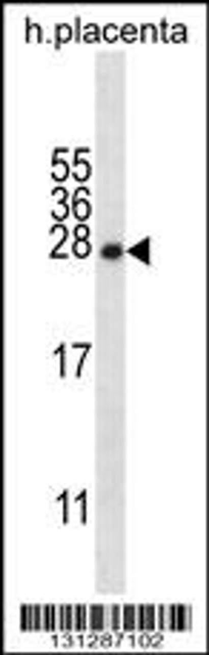 Western blot analysis in human placenta tissue lysates (35ug/lane) .