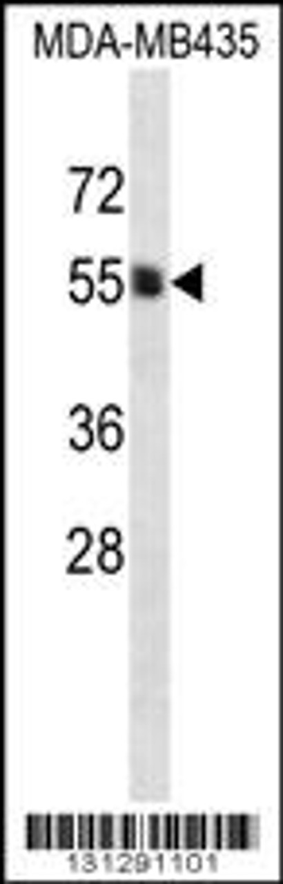 Western blot analysis in MDA-MB435 cell line lysates (35ug/lane) .