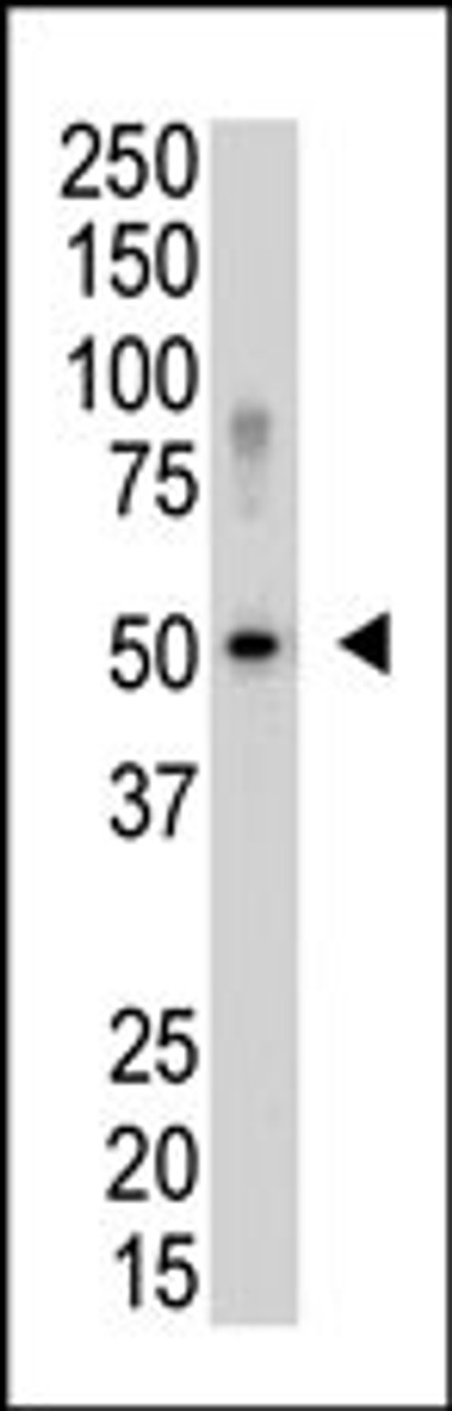 Western blot analysis of SENP5 polyclonal antibody in Saos-2 cell lysate