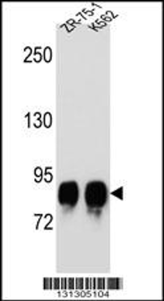 Western blot analysis in ZR-75-1, K562 cell line lysates (35ug/lane) .