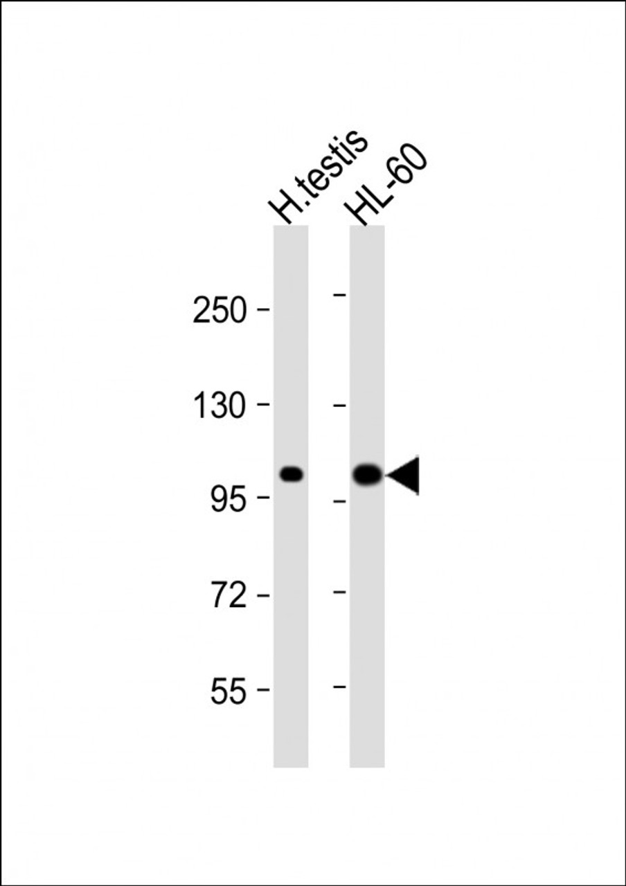 Western Blot at 1:1000 dilution Lane 1: human testis lysate Lane 2: HL-60 whole cell lysate Lysates/proteins at 20 ug per lane.