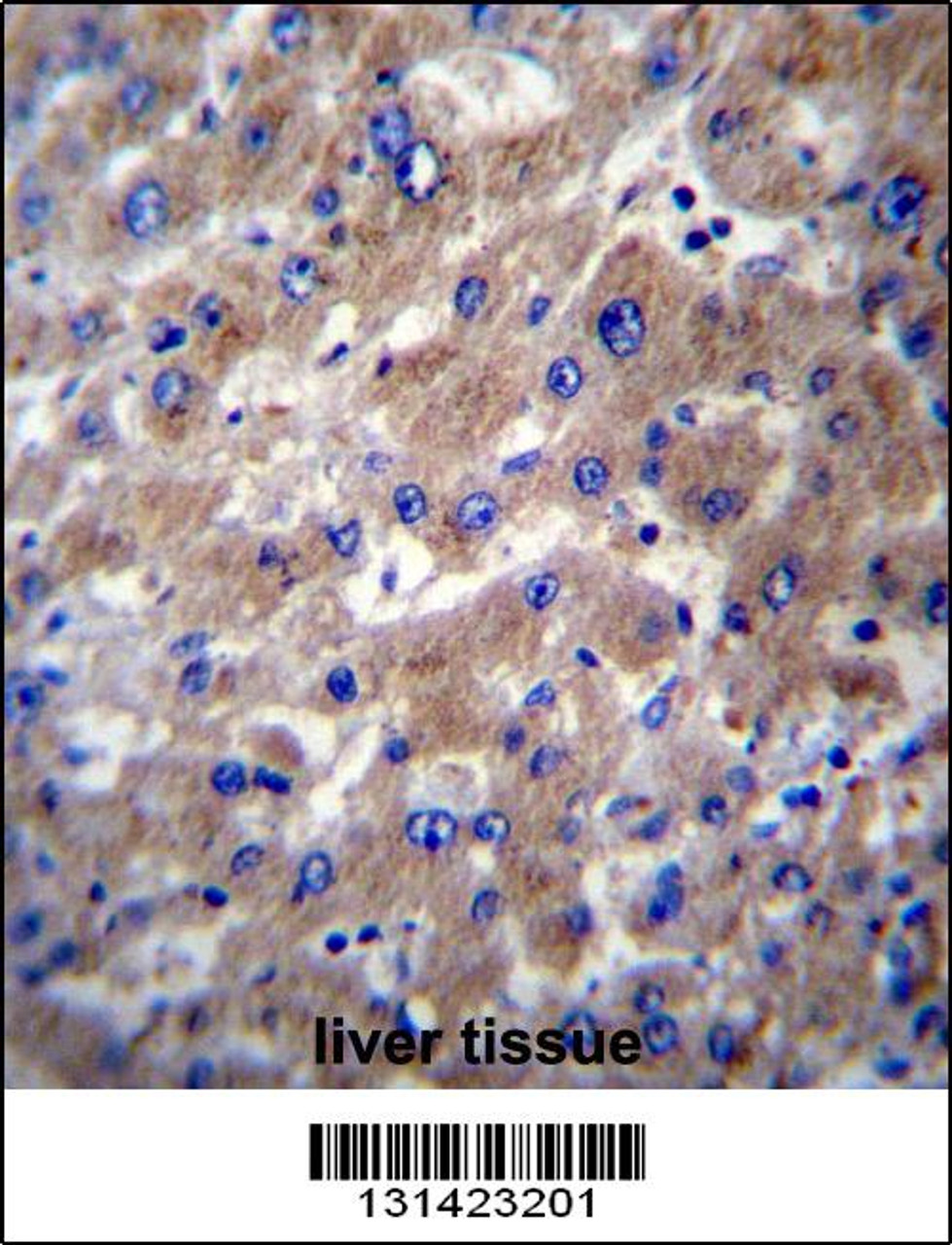 SLMO2 Antibody immunohistochemistry analysis in formalin fixed and paraffin embedded human liver tissue followed by peroxidase conjugation of the secondary antibody and DAB staining.