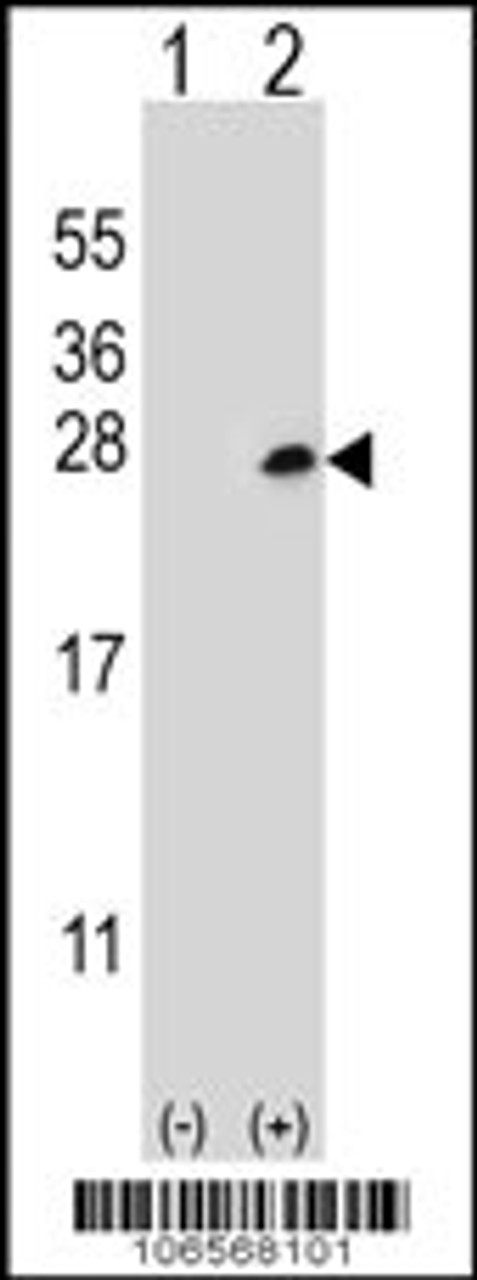 Western blot analysis of Dok5 using rabbit polyclonal Dok5 Antibody (PTB domain) using 293 cell lysates (2 ug/lane) either nontransfected (Lane 1) or transiently transfected (Lane 2) with the Dok5 gene.