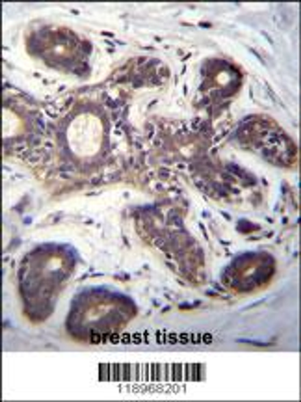 EIF2B1 Antibody immunohistochemistry analysis in formalin fixed and paraffin embedded human breast tissue followed by peroxidase conjugation of the secondary antibody and DAB staining.