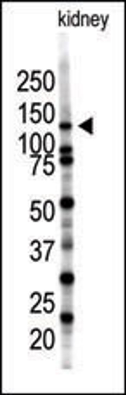 Western blot analysis of SENP7 polyclonal antibody in mouse kidney tissue lysate (35ug/lane) .