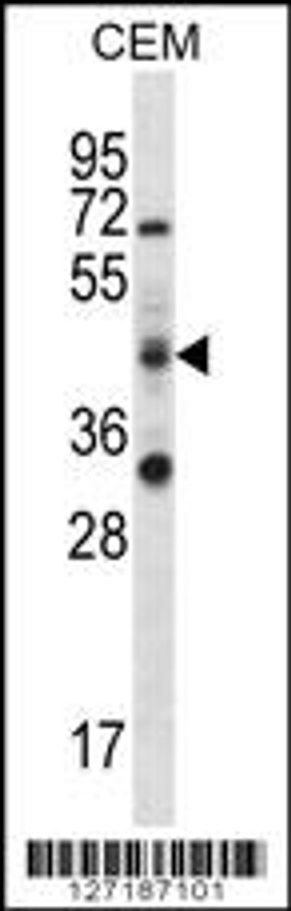 Western blot analysis in CEM cell line lysates (35ug/lane) .