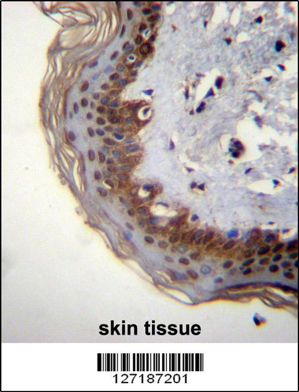 RBM42 Antibody immunohistochemistry analysis in formalin fixed and paraffin embedded human skin tissue followed by peroxidase conjugation of the secondary antibody and DAB staining.