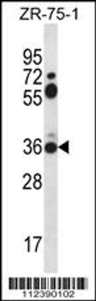 Western blot analysis in ZR-75-1 cell line lysates (35ug/lane) .