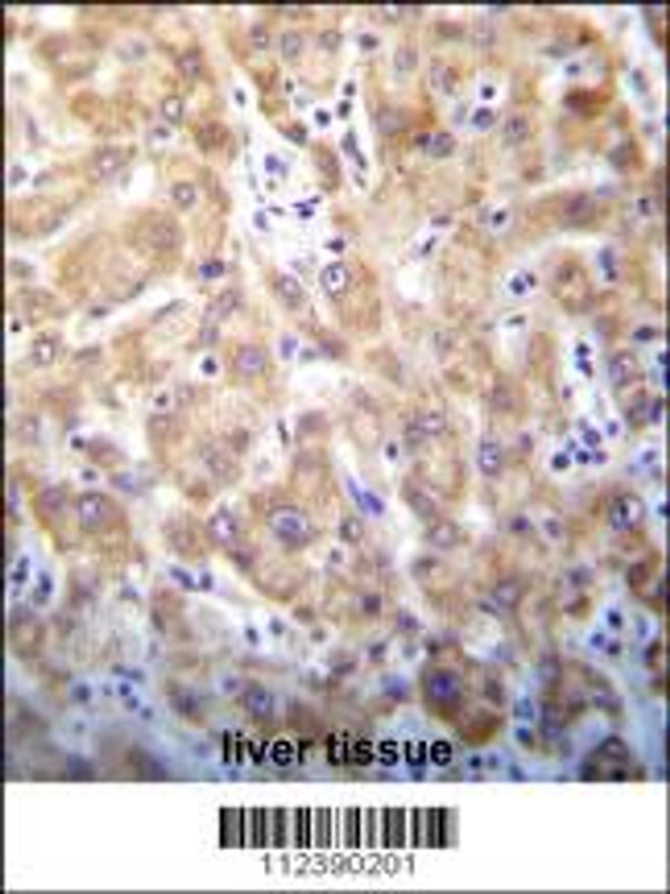 STX2 Antibody immunohistochemistry analysis in formalin fixed and paraffin embedded human liver tissue followed by peroxidase conjugation of the secondary antibody and DAB staining.