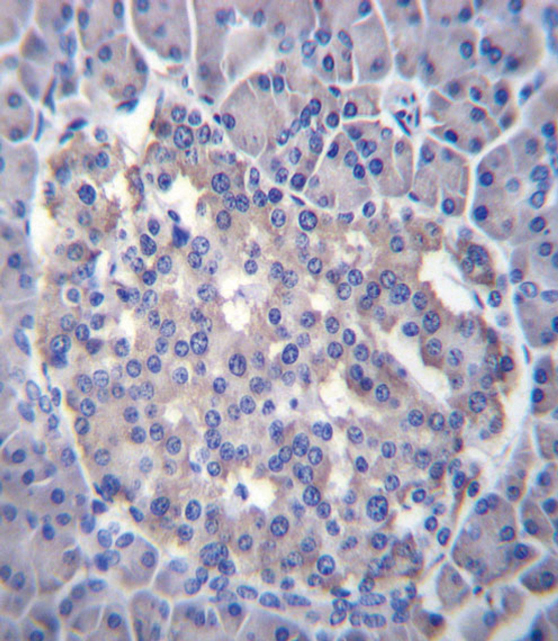 Sest immunohistochemistry analysis in formalin fixed and paraffin embedded human pancreas tissue followed by peroxidase conjugation of the secondary antibody and DAB staining.This data demonstrates the use of Sest for immunohistochemistry.