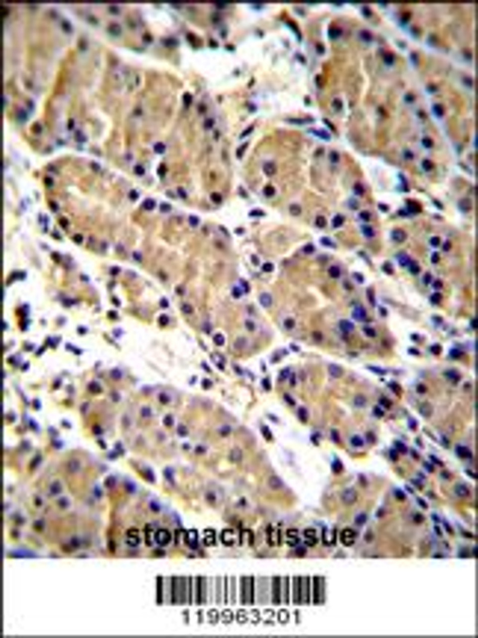 immunohistochemistry analysis in formalin fixed and paraffin embedded human stomach tissue followed by peroxidase conjugation of the secondary antibody and DAB staining.