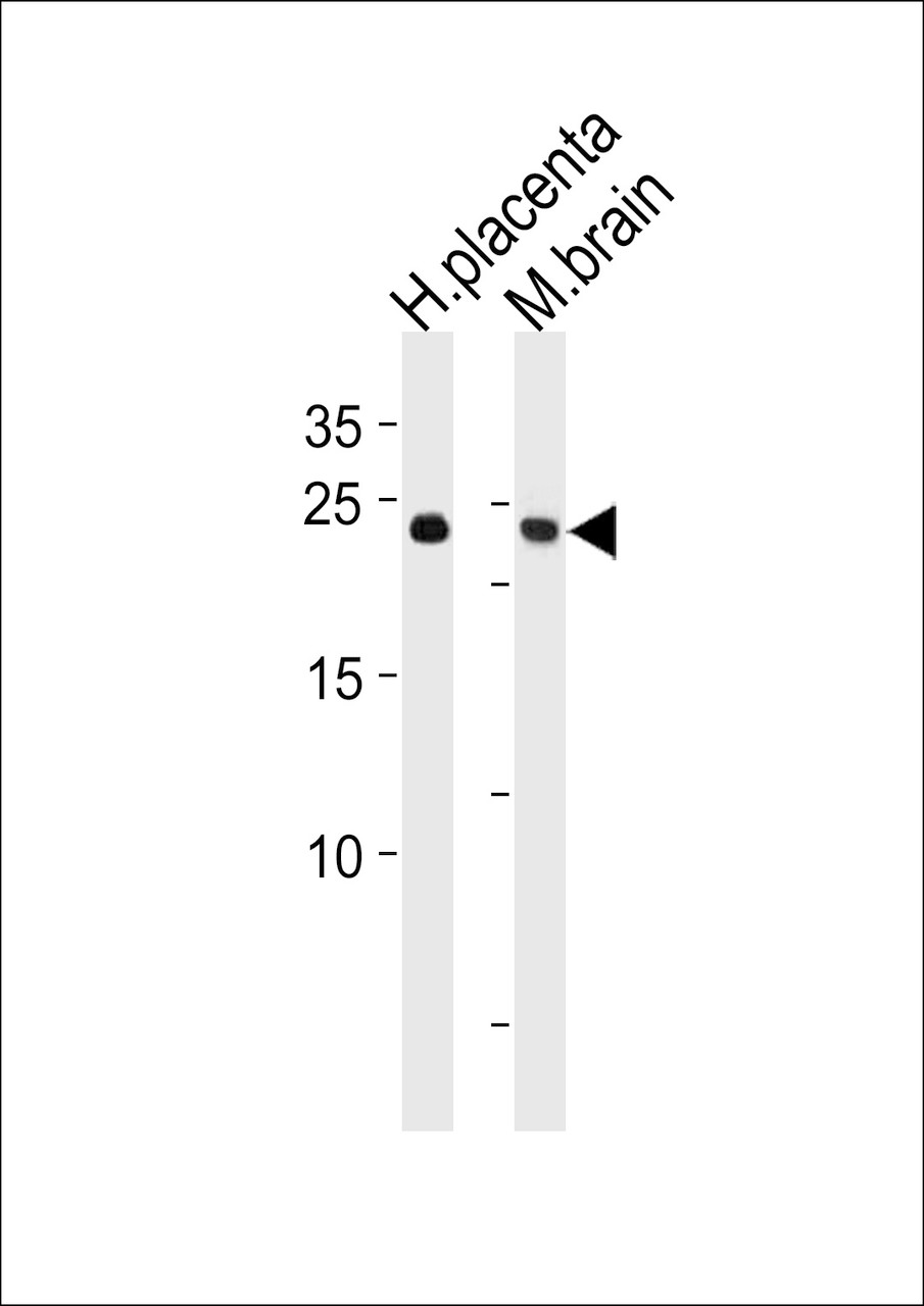 Western blot analysis in human placenta and mouse brain tissue lysates (35ug/lane) .