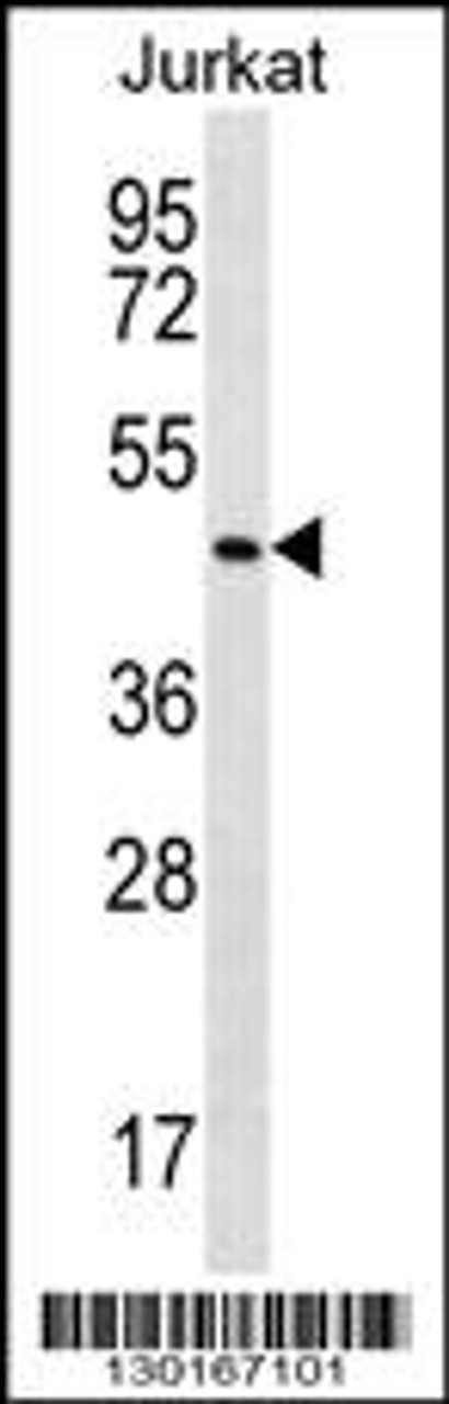 Western blot analysis in Jurkat cell line lysates (35ug/lane) .This demonstrates the MAPK14 antibody detected the MAPK14 protein (arrow) .