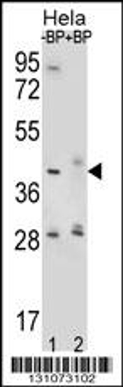 Western blot analysis of HYAL2 Antibody Pab pre-incubated without (lane 1) and with (lane 2) blocking peptide in Hela cell line lysate.