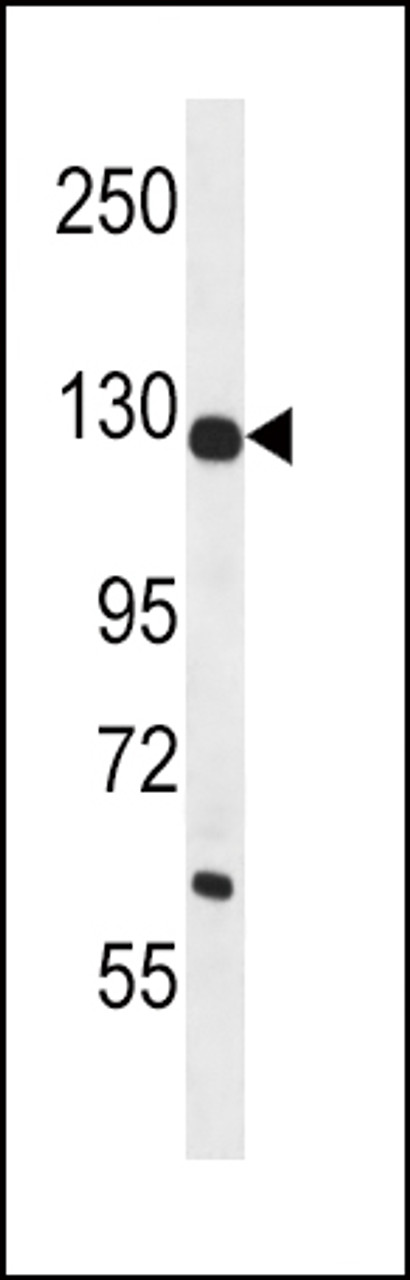 Western blot analysis in mouse liver tissue lysates (35ug/lane) .