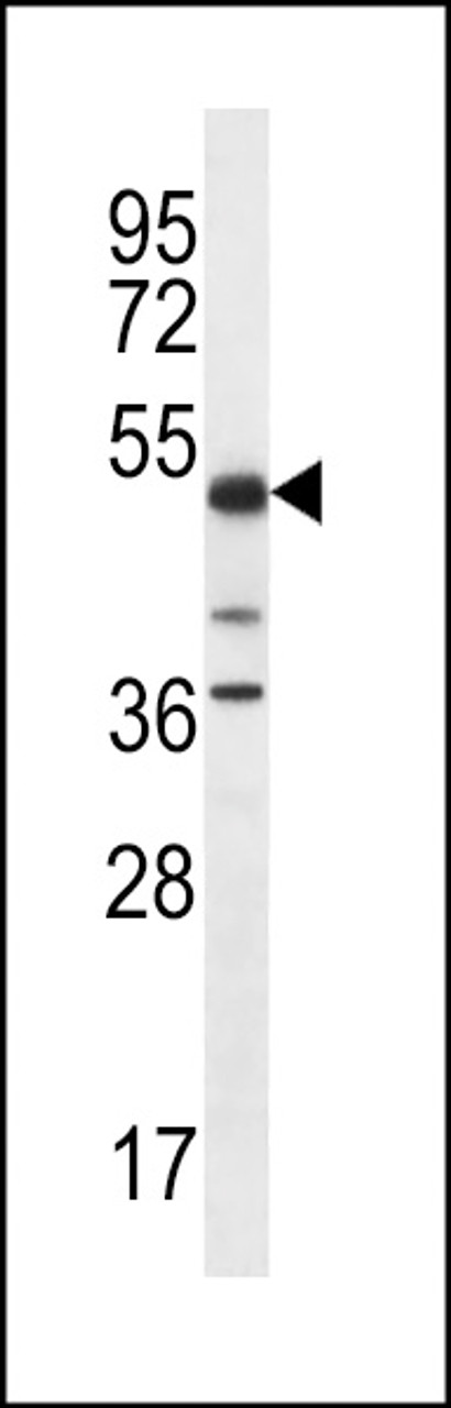 Western blot analysis in K562 cell line lysates (35ug/lane) .