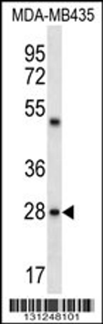 Western blot analysis in MDA-MB435 cell line lysates (35ug/lane) .