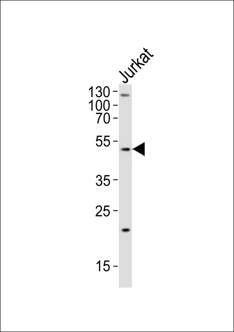 Western blot analysis of lysate from Jurkat cell line, using GAA Antibody at 1:2000.